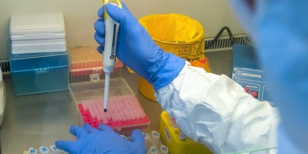 Калужский Минздрав объяснил длительное ожидание результатов тестов на коронавирус