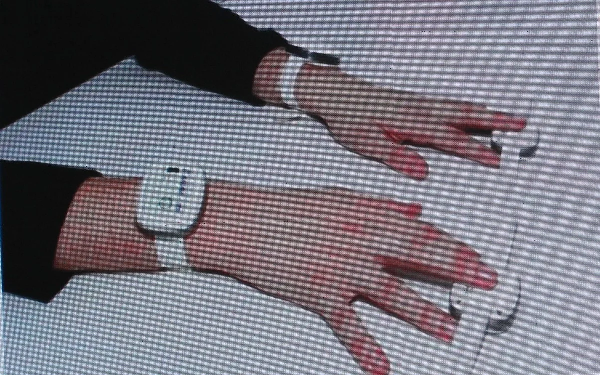 Так выглядит метод лазерной допплеровской флоуметрии.